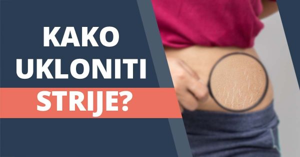 Kako ukloniti strije