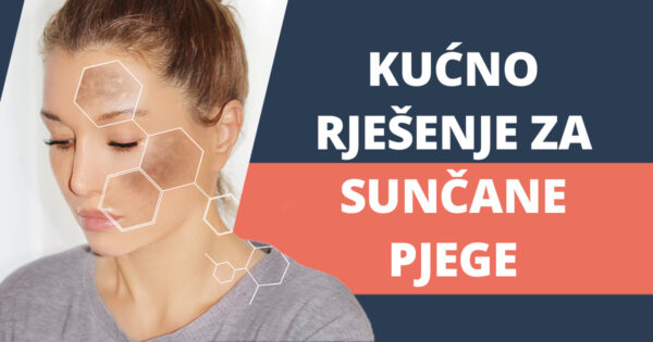 Suncane pjege kako ih ukloniti